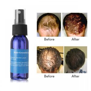 Okeny&#039;s Brand Yuda Pilatory Stop HairLoss Fast Hair Growth Spray Liquid Hair Essence