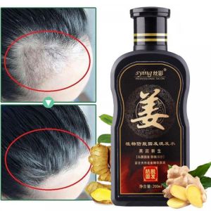 200ml Natural Ginger Shampoo Oil-Control Anti Dandruff Anti Hair Loss Hair Growth Essence