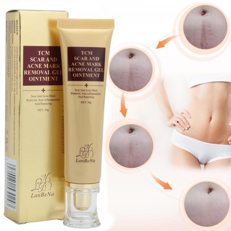 shopping טיפוח העור 30g Acne Scar Removal Cream Skin Repair Cream Cream