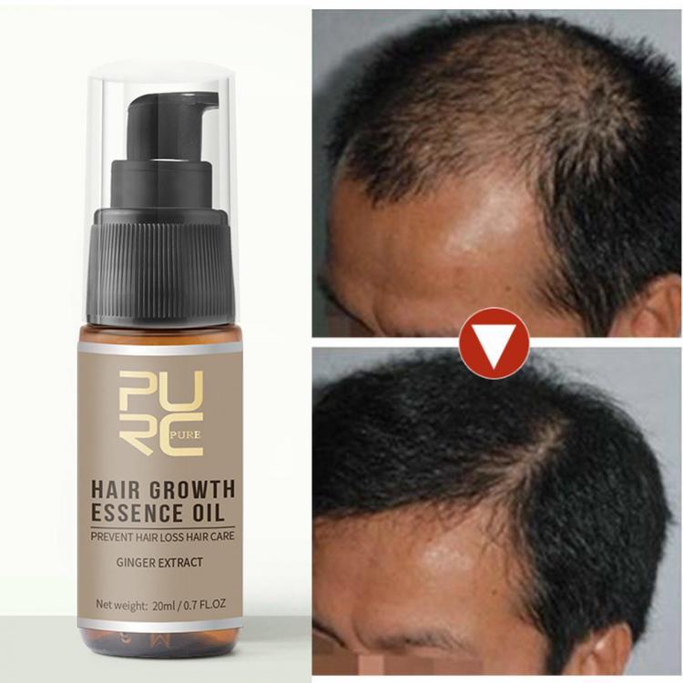 shopping שיער ואביזרים 20ml Hair Growth Treatment Hair Loss Spray Hair Essence Oil